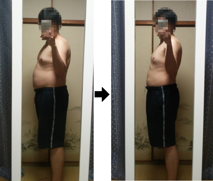 断食前と断食して48時間後を比較した写真(前腹)